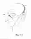 Fig. 44 - DELIVERY OF RESPIRATORY THERAPY