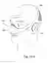 Fig. 48 - DELIVERY OF RESPIRATORY THERAPY