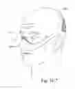 Fig. 49 - DELIVERY OF RESPIRATORY THERAPY