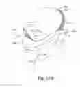 Fig. 50 - DELIVERY OF RESPIRATORY THERAPY