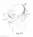 Fig. 51 - DELIVERY OF RESPIRATORY THERAPY