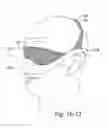 Fig. 54 - DELIVERY OF RESPIRATORY THERAPY