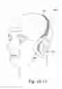 Fig. 58 - DELIVERY OF RESPIRATORY THERAPY