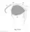 Fig. 61 - DELIVERY OF RESPIRATORY THERAPY