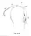 Fig. 64 - DELIVERY OF RESPIRATORY THERAPY