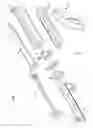 Fig. 04 - Insertion device for one-handed insertion of a guidewire into the lumen of a vessel/cavity