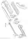 Fig. 17 - Insertion device for one-handed insertion of a guidewire into the lumen of a vessel/cavity