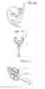 Fig. 29 - Insertion device for one-handed insertion of a guidewire into the lumen of a vessel/cavity