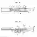 Fig. 34 - Insertion device for one-handed insertion of a guidewire into the lumen of a vessel/cavity