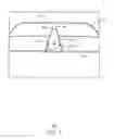 Fig. 02 - Balloon catheter
