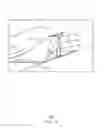 Fig. 04 - Balloon catheter
