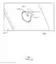 Fig. 10 - Balloon catheter