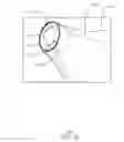 Fig. 16 - Balloon catheter