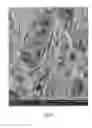 Fig. 05 - Apparatus and methods for enhanced drug delivery