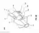 Fig. 12 - Fluid flow control by a non-pinching valve