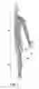 Fig. 04 - PERCUTANEOUS LEAD