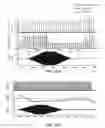 Fig. 29 - PERCUTANEOUS LEAD
