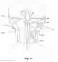 Fig. 11 - SYSTEMS AND METHODS FOR THE TREATMENT OF HEAD PAIN