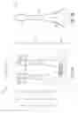Fig. 11 - NASAL STIMULATION DEVICES AND METHODS FOR TREATING DRY EYE