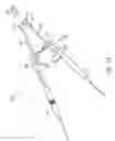 Fig. 25 - NASAL STIMULATION DEVICES AND METHODS FOR TREATING DRY EYE