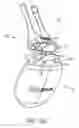 Fig. 26 - NASAL STIMULATION DEVICES AND METHODS FOR TREATING DRY EYE