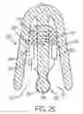 Fig. 41 - NASAL STIMULATION DEVICES AND METHODS FOR TREATING DRY EYE