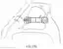 Fig. 45 - NASAL STIMULATION DEVICES AND METHODS FOR TREATING DRY EYE