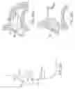 Fig. 57 - NASAL STIMULATION DEVICES AND METHODS FOR TREATING DRY EYE