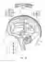 Fig. 02 - Electrical substance clearance from the brain