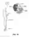 Fig. 14 - System and method to percutaneously block painful sensations