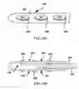 Fig. 22 - System and method to percutaneously block painful sensations