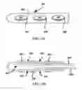 Fig. 22 - System and method to percutaneously block painful sensations