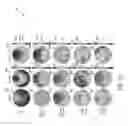 Fig. 17 - METHOD FOR NON-INVASIVE ENHANCEMENT OF DEEP SLEEP