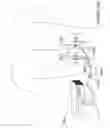 Fig. 17 - METHODS AND APPARATUS FOR RENAL NEUROMODULATION