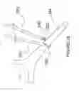 Fig. 20 - METHODS AND APPARATUS FOR RENAL NEUROMODULATION
