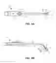 Fig. 05 - Implantable electrical stimulator with deflecting tip lead