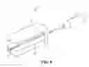 Fig. 10 - Implantable electrical stimulator with deflecting tip lead