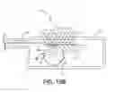 Fig. 12 - Implantable electrical stimulator with deflecting tip lead