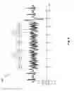 Fig. 13 - Changing cardiac shock delivery parameters based on a transform value