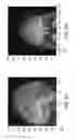 Fig. 07 - METHODS AND APPARATUS FOR TREATMENT OF DISORDERS