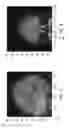 Fig. 08 - METHODS AND APPARATUS FOR TREATMENT OF DISORDERS