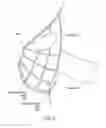 Fig. 07 - System and method for manufacturing bolus for radiotherapy using a three-dimensional printer