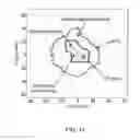 Fig. 12 - System and method for manufacturing bolus for radiotherapy using a three-dimensional printer