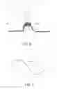 Fig. 06 - Apparatus, system, and method for neurostimulation by high frequency ultrasound