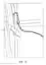Fig. 12 - Free weight exercise swing attachment