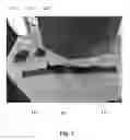 Fig. 03 - Hand Positioning Strap System for Athletic Training