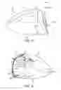 Fig. 11 - Golf club head