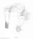 Fig. 03 - HEAD AND NECK RESTRAINT DEVICE WITH DYNAMIC ARTICULATION