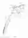 Fig. 04 - HEAD AND NECK RESTRAINT DEVICE WITH DYNAMIC ARTICULATION