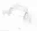 Fig. 06 - HEAD AND NECK RESTRAINT DEVICE WITH DYNAMIC ARTICULATION
